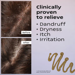 KAMEDIS Scalp Moisturizer Lotion overnight ritual suggests calmer mornings