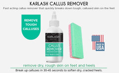 Karlash Callos Remover con piedra pómez incluida para suavizar callos
