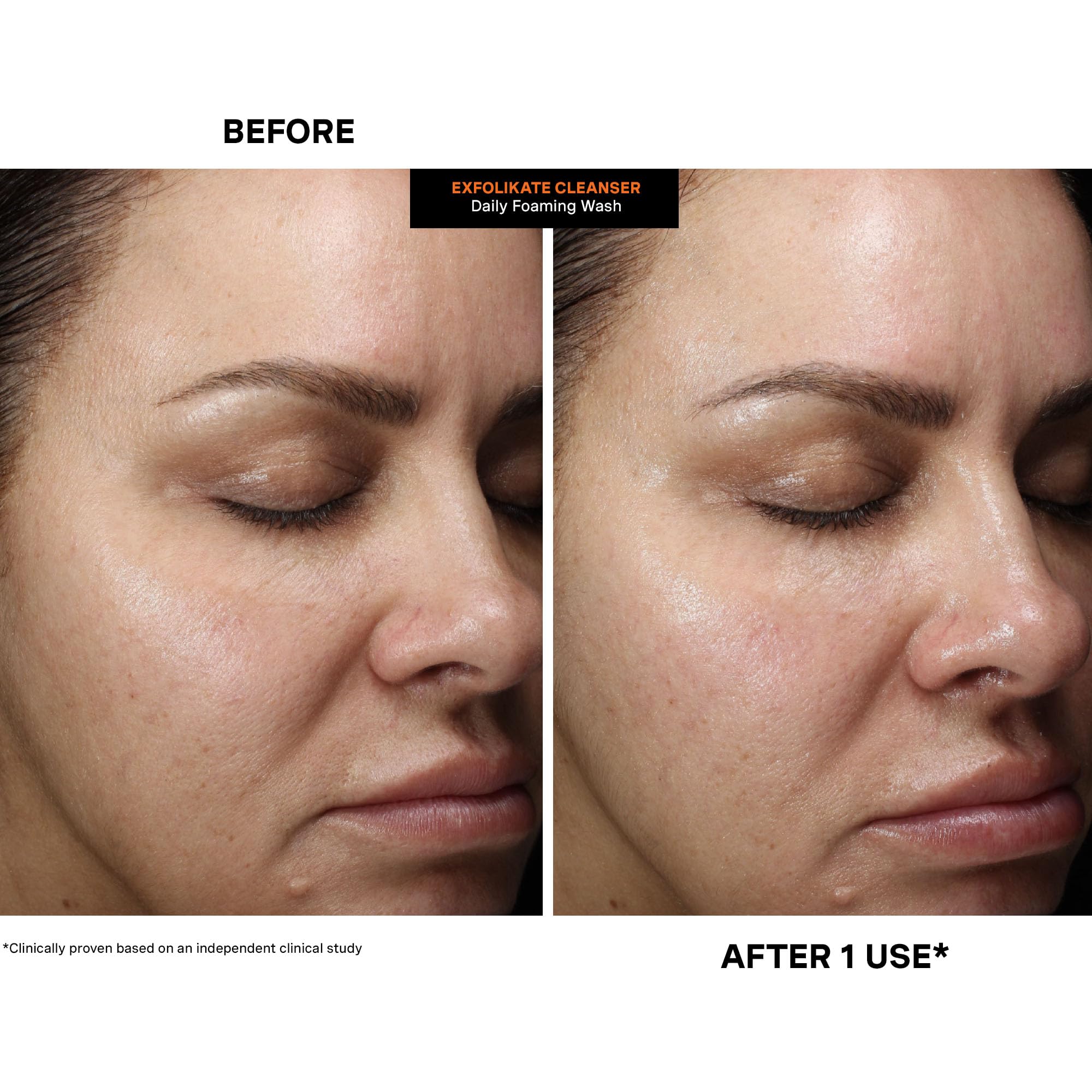 Kate Somerville Exfolikate Cleanser foaming-lather texture mid-application