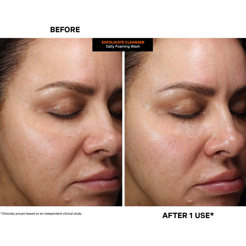 Kate Somerville Exfolikate Cleanser foaming-lather texture mid-application