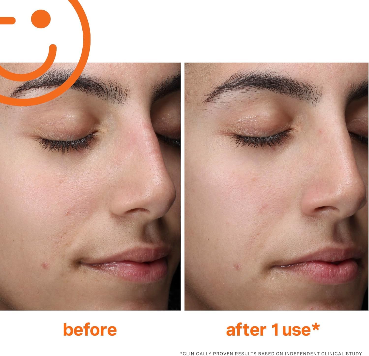Kate Somerville ExfoliKate Cleanser glycolic and lactic acids for smoother skin texture.