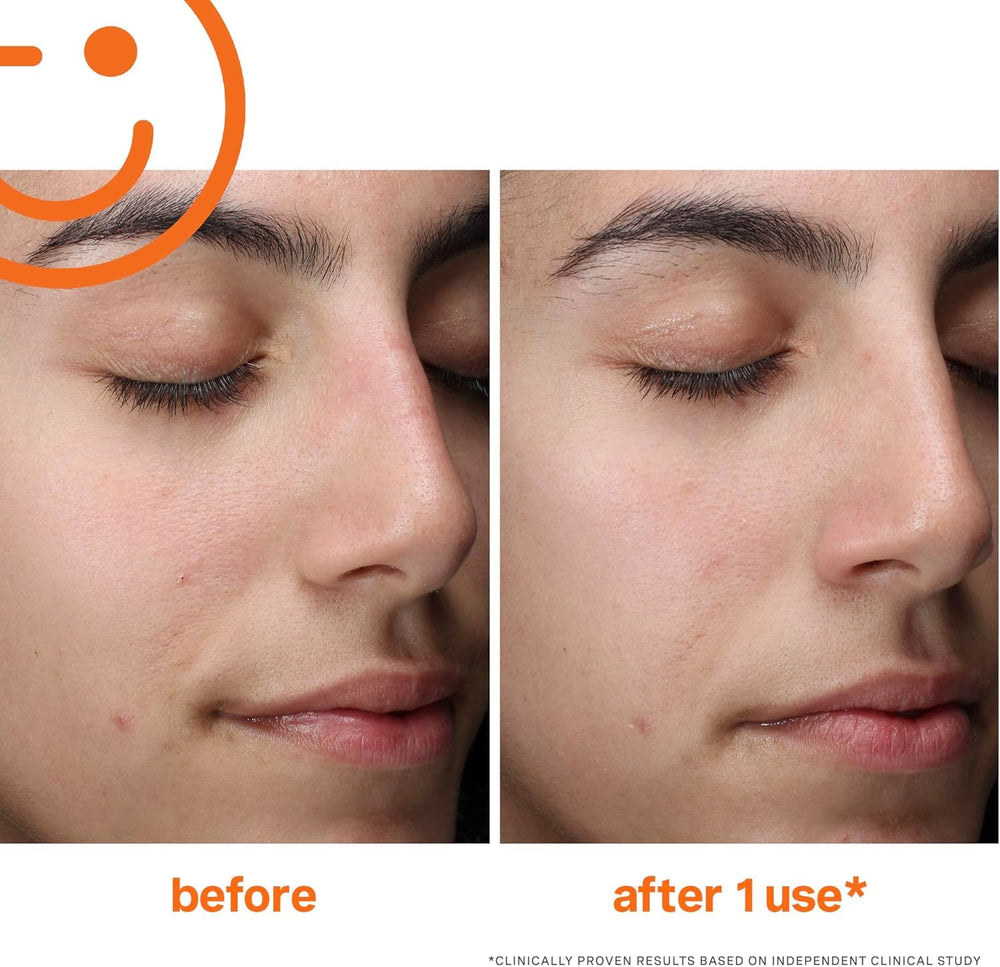 Kate Somerville ExfoliKate Cleanser glycolic and lactic acids for smoother skin texture.