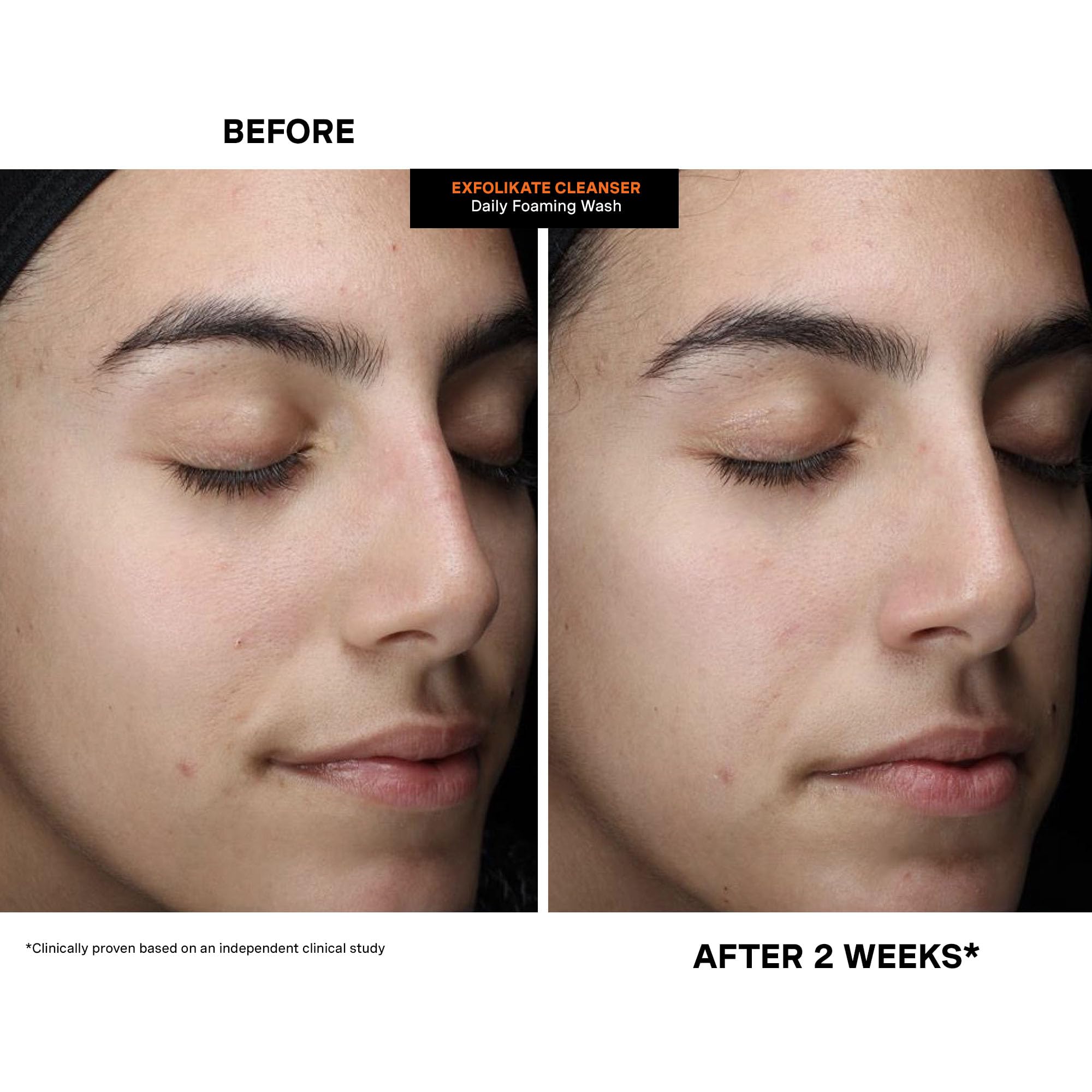 Kate Somerville Exfolikate Cleanser used in a nighttime routine and rinse
