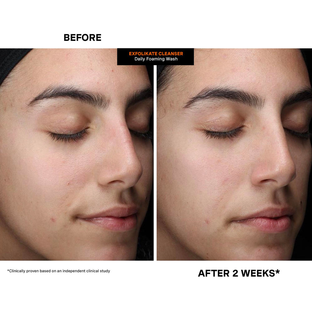 Kate Somerville Exfolikate Cleanser used in a nighttime routine and rinse