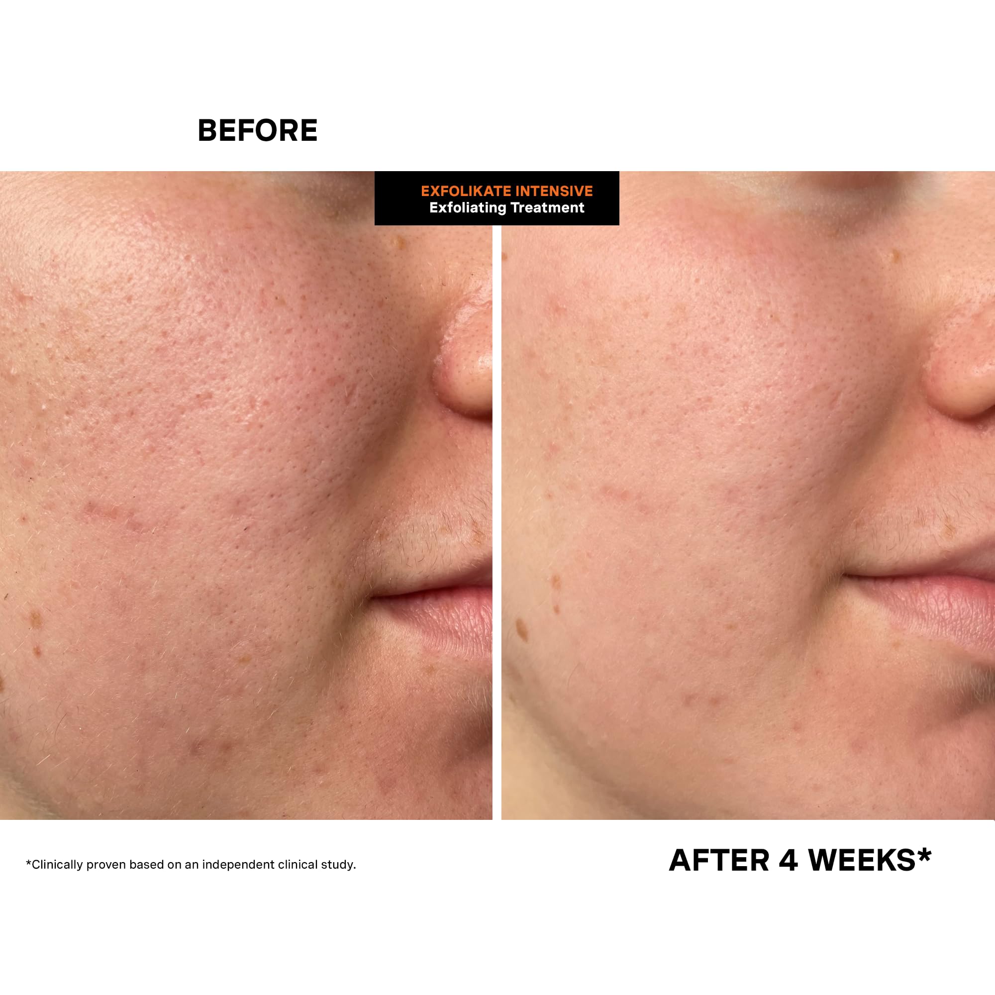 Kate Somerville ExfoliKate Intensive Scrub no harsh additives highlight