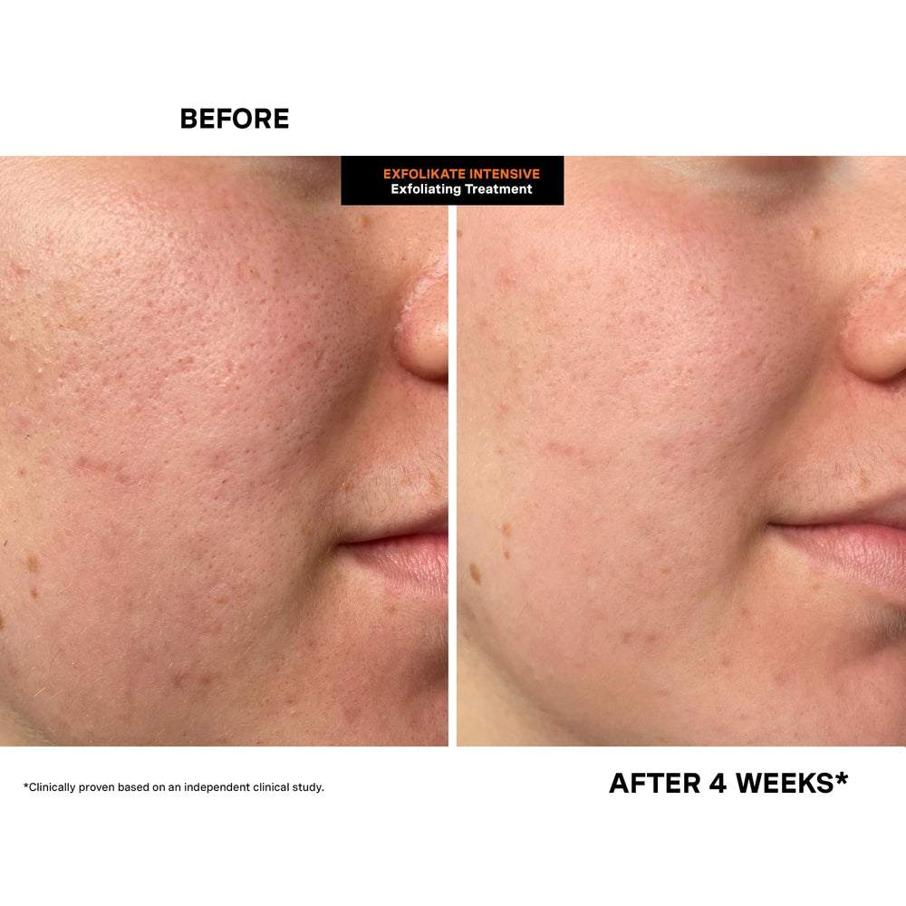 Kate Somerville ExfoliKate Intensive Scrub no harsh additives highlight