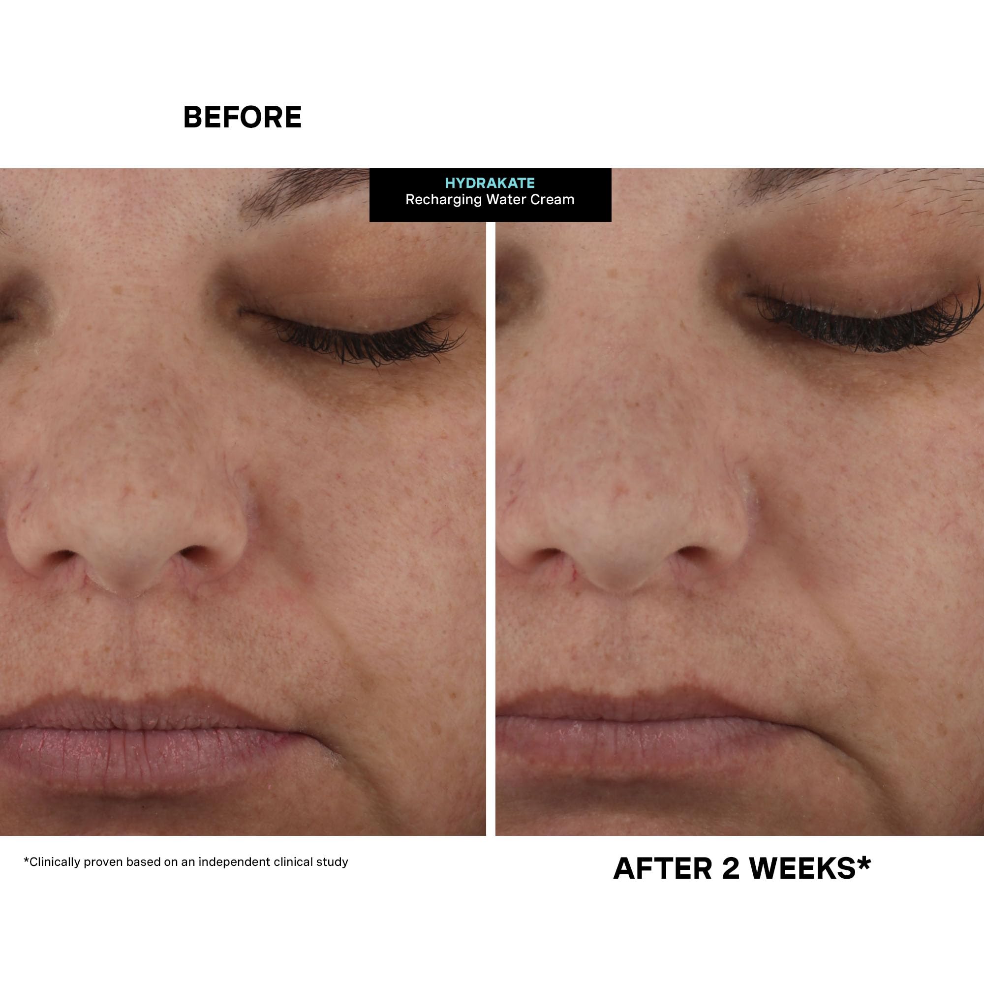 AquaPort tech illustration with HydraKate for targeted hydration