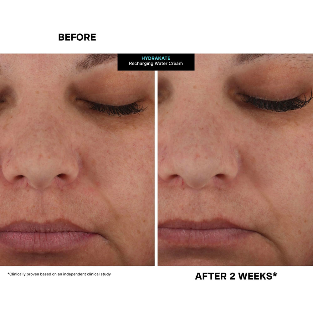 AquaPort tech illustration with HydraKate for targeted hydration