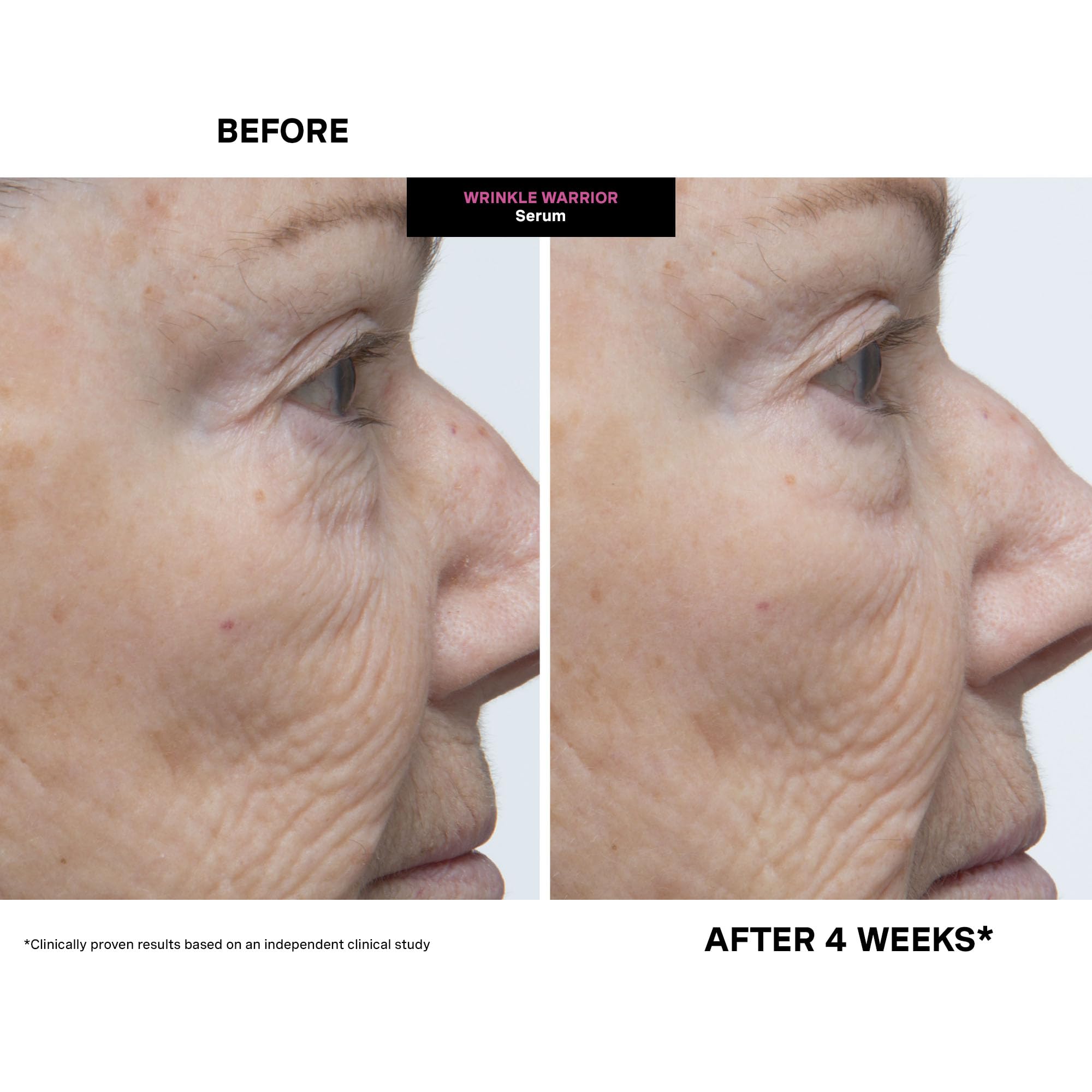Kate Somerville Wrinkle Warrior jar packaging hints at luxury skincare experience