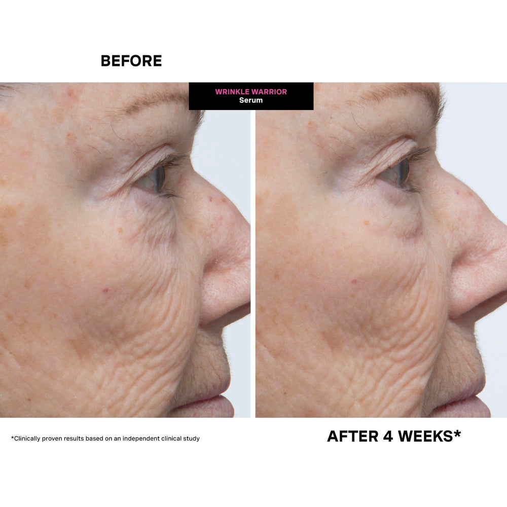Kate Somerville Wrinkle Warrior jar packaging hints at luxury skincare experience