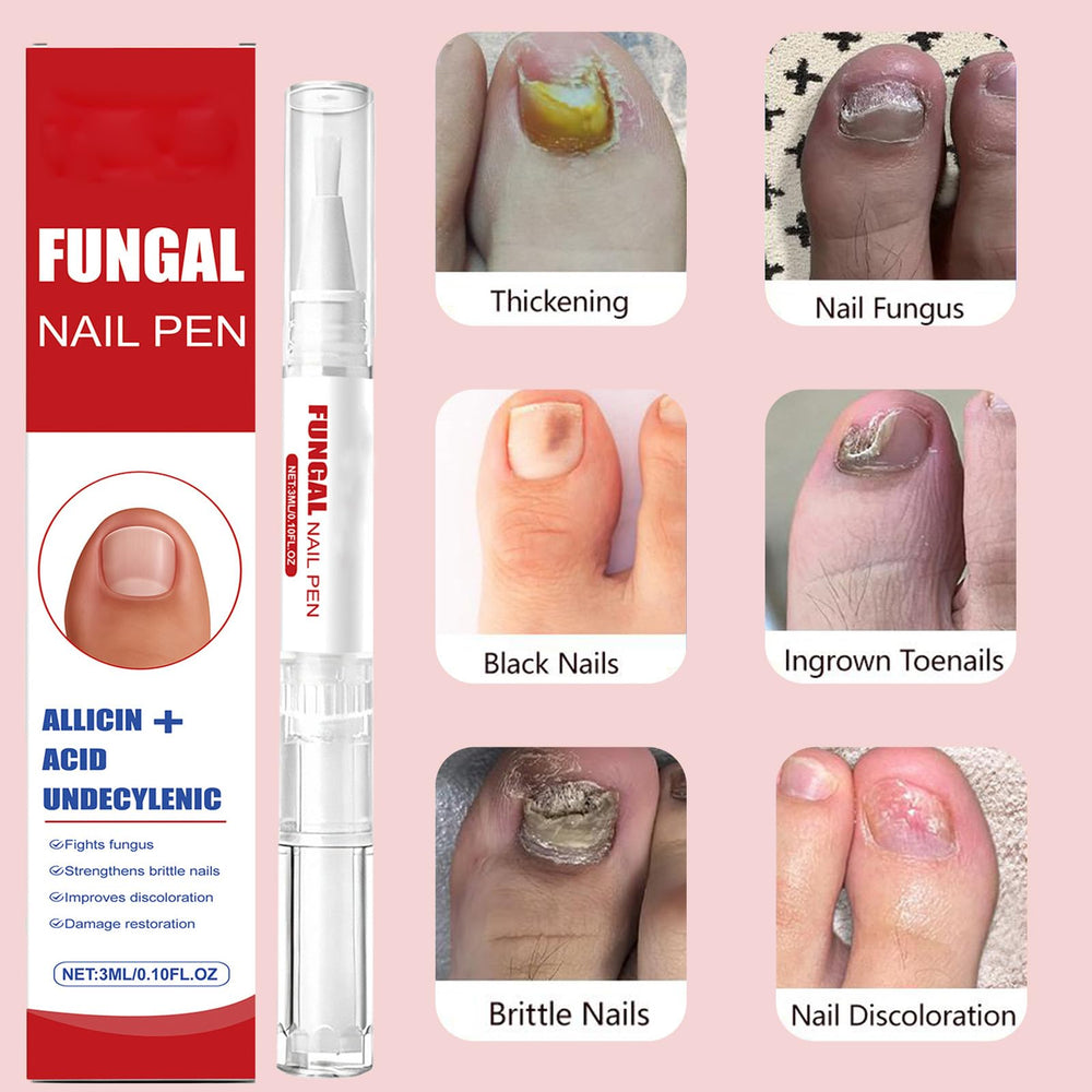KBSBUBB Fungal Nail Pen non-greasy formula absorbing quickly on nails