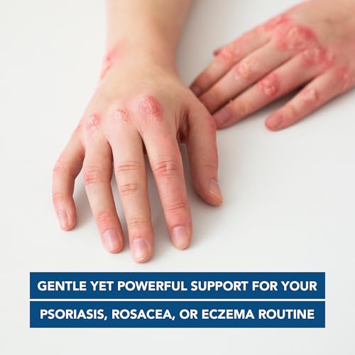 Kenkoderm Psoriasis Dead Sea Salt Soap daily routine feature for gentle cleansing.