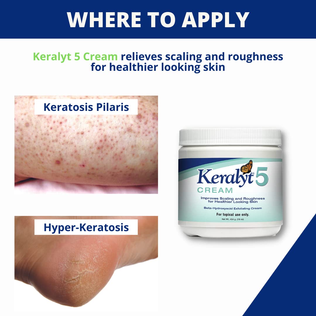 Keralyt psoriasis cream after bath ready for sealing in moisture
