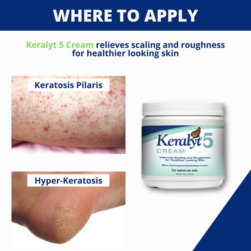 Keralyt psoriasis cream after bath ready for sealing in moisture