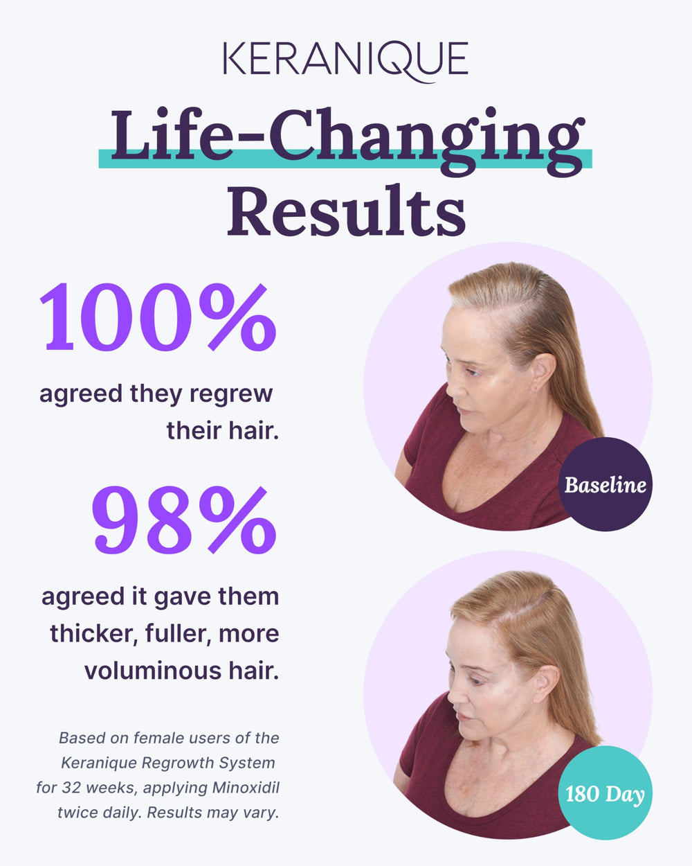 Keranique 2percent minoxidil bottle shown for thinning coverage