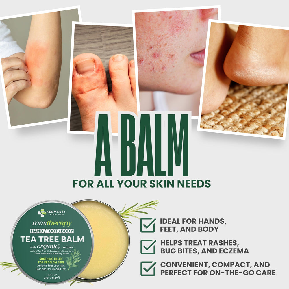 KESMEDIK balm being applied to irritated skin for cooling relief