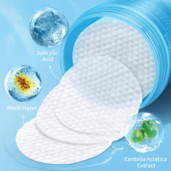 Kestper pads infused with witch hazel for soothing redness and gentle toning.