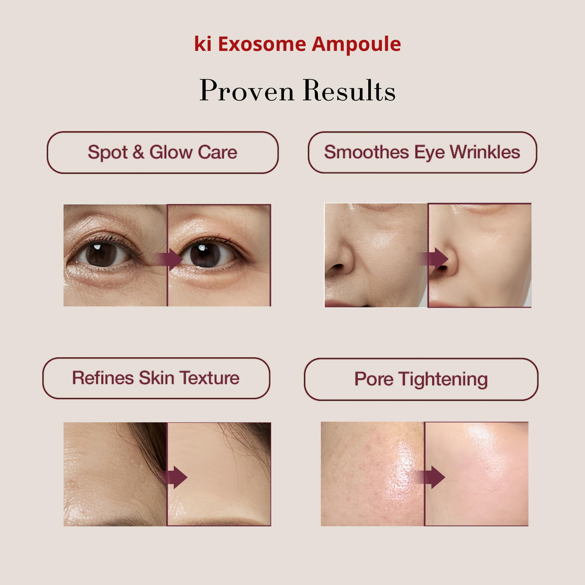 Ki Cosmetics exosome-PDRN-peptide-ingredients label highlights premium actives for skin support.