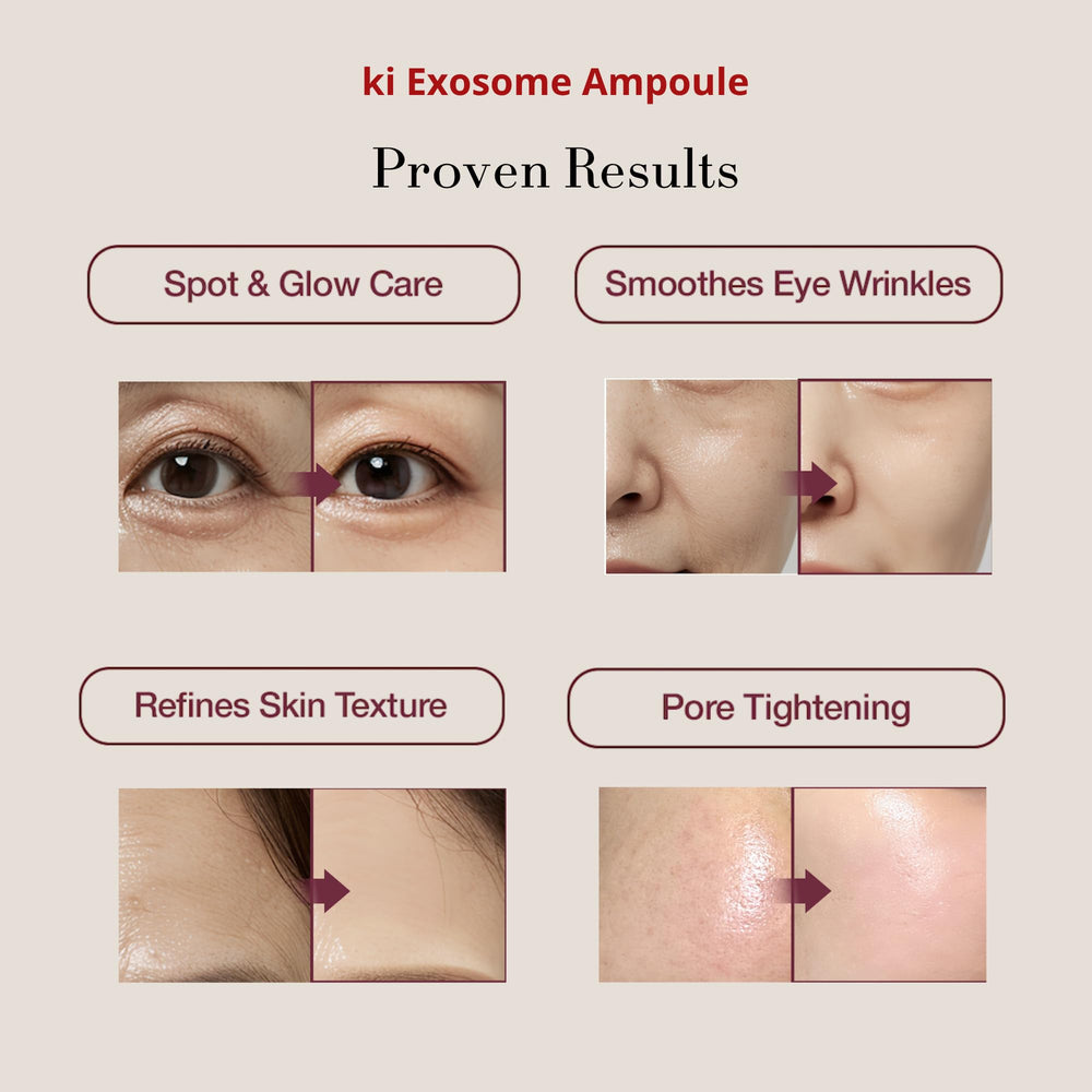 Ki Cosmetics exosome-PDRN-peptide-ingredients label highlights premium actives for skin support.
