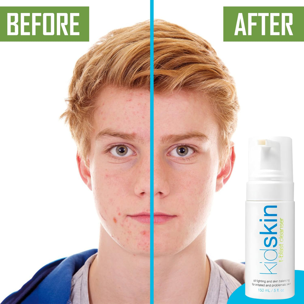 Kidskin T-Blast cleanser in a bathroom sink setup for easy routine