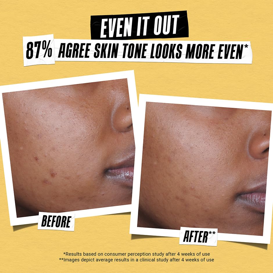 Kiehl's Better Screen UV Serum SPF 50+ label with broad protection visuals.