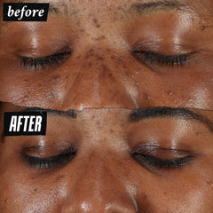 Kiehl's Clearly Corrective Serum amber liquid highlights stabilized Vitamin C