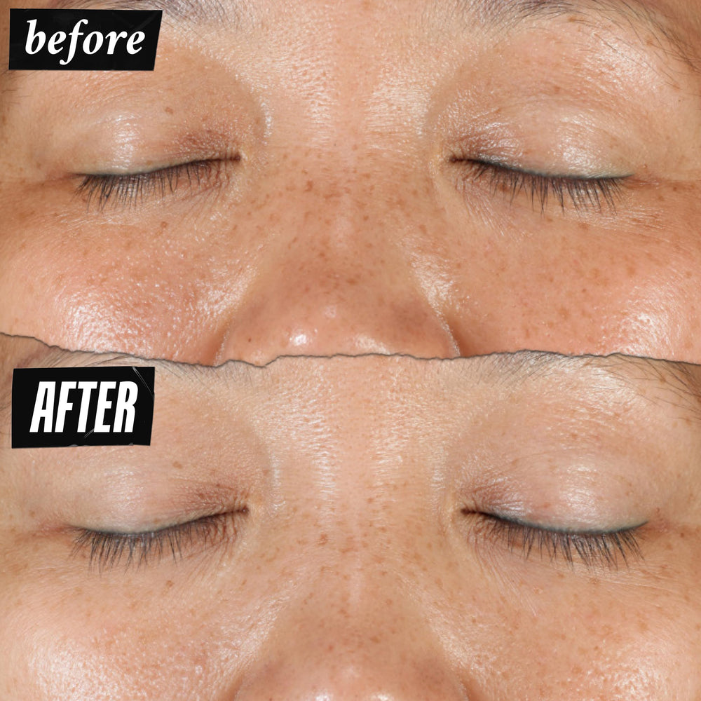 Kiehl's Clearly Corrective Serum dot application on skin for targeting