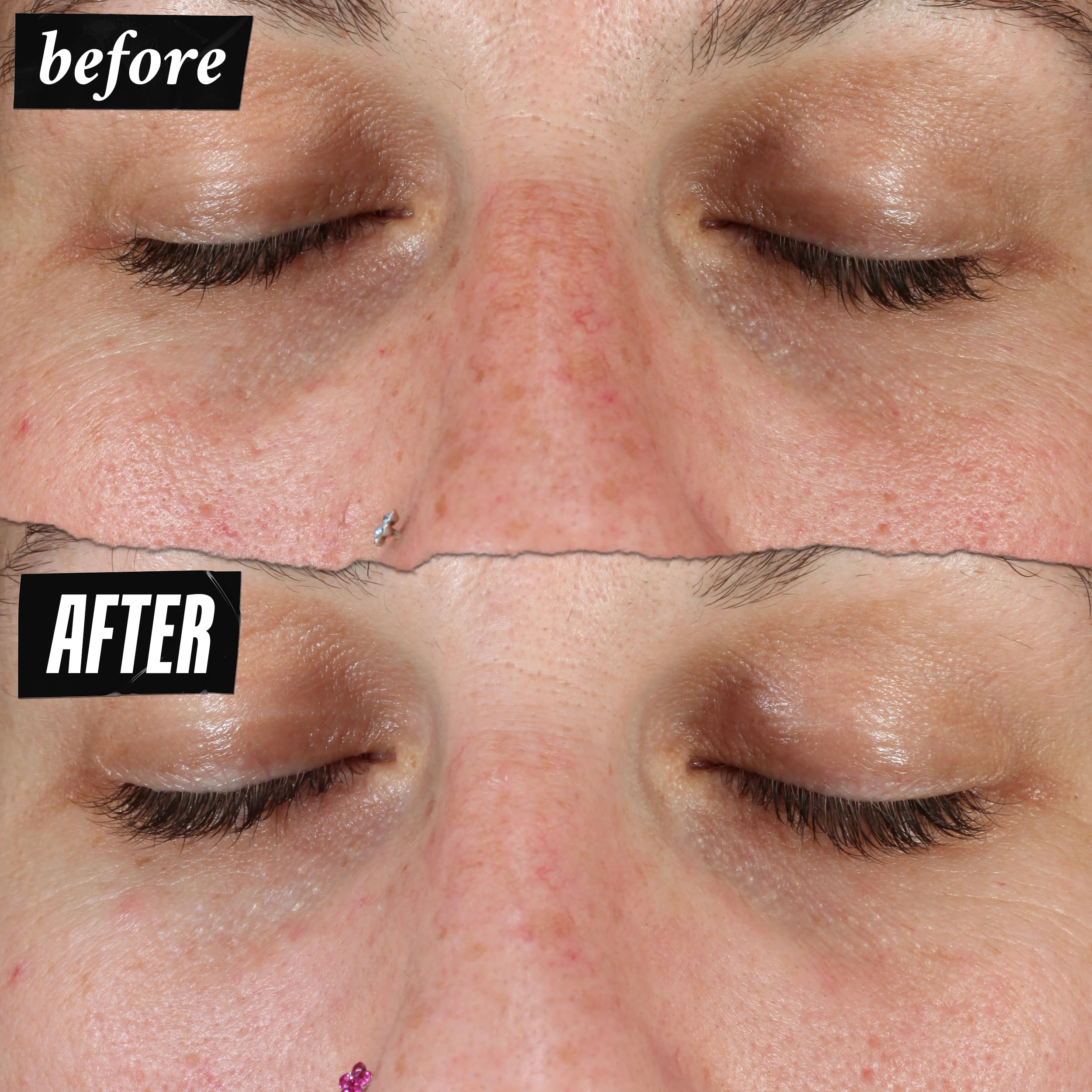 Kiehl's Clearly Corrective Serum on face for even skin tone
