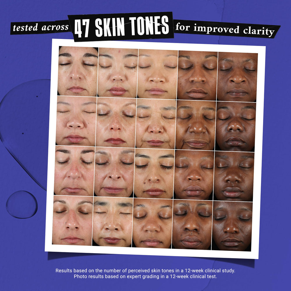 Kiehl's Clearly Corrective Serum on hands and neck for discolorations