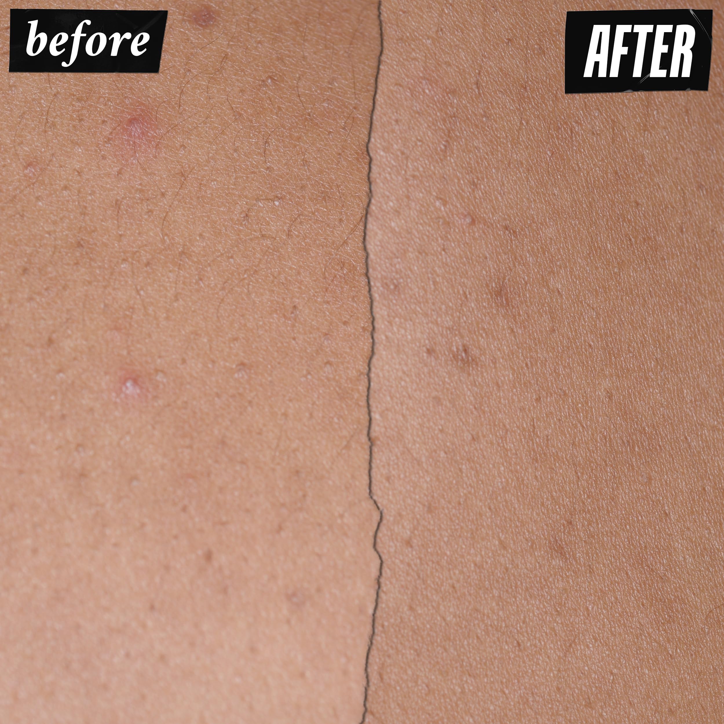 Kiehl's Expertly Clear niacinamide ingredient closeup emphasizes barrier support and even tone
