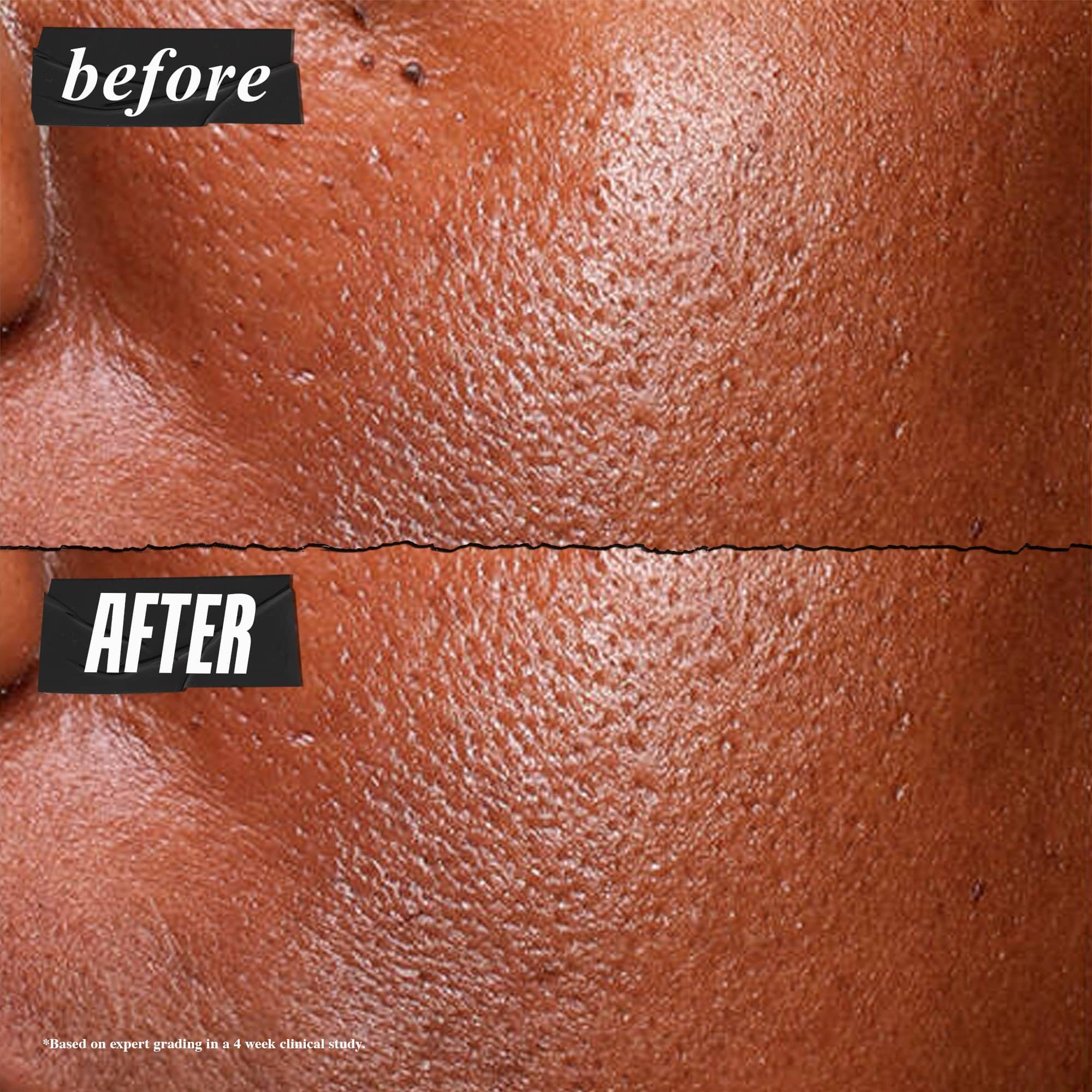 Kiehl's Niacinamide serum texture close-up illustrating light, non-sticky finish for oily skin.