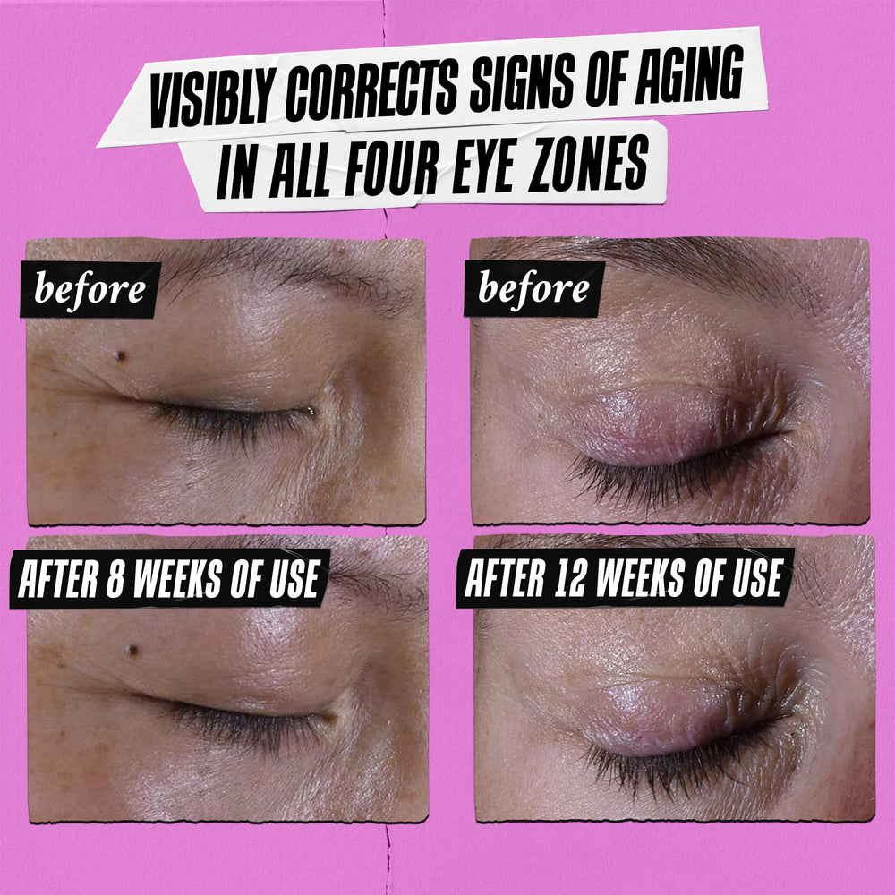 Kiehl's Super Multi-Corrective Eye Cream brow bone lift in action on model