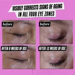 Kiehl's Super Multi-Corrective Eye Cream brow bone lift in action on model