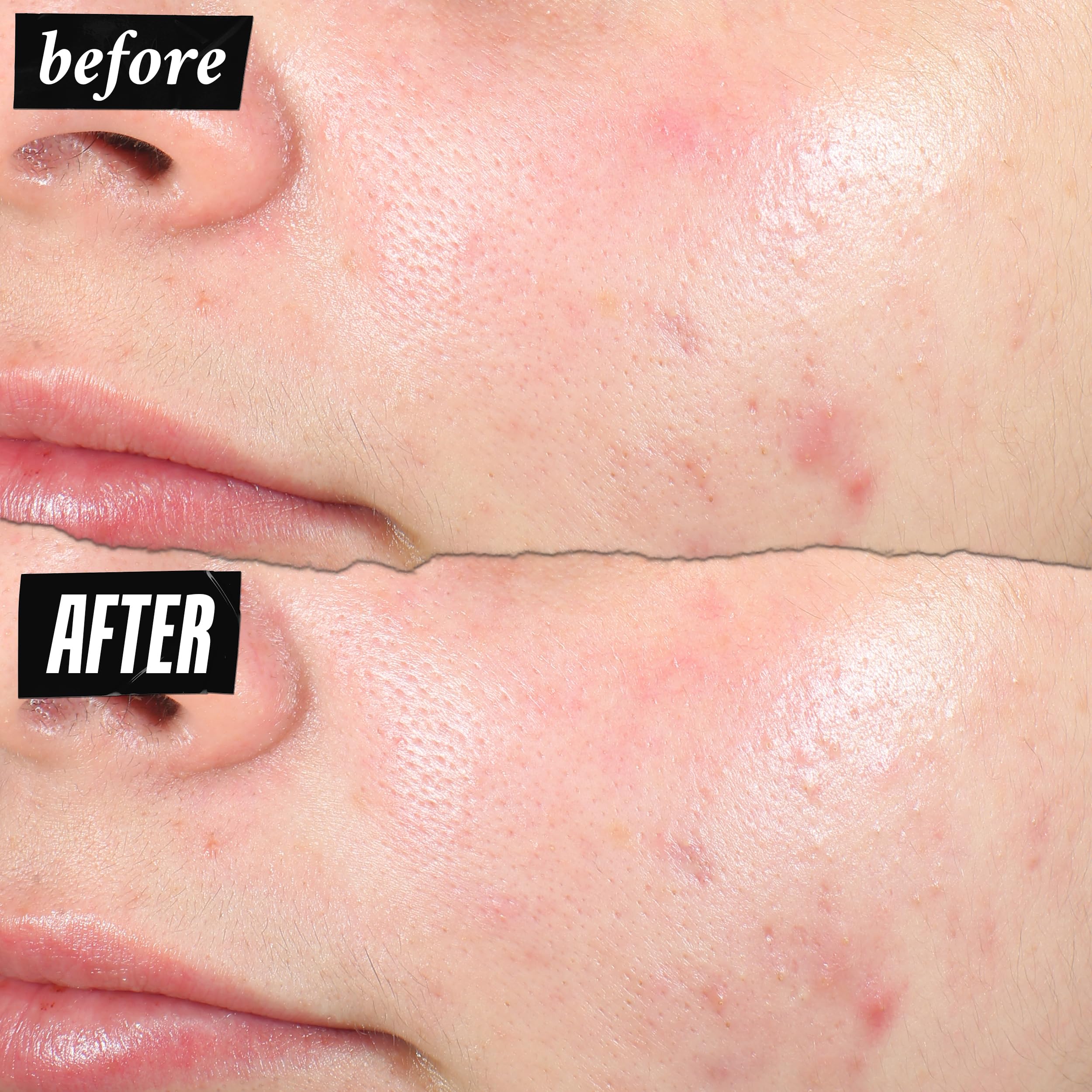 Kiehl's patch licorice root soothing for redness relief.