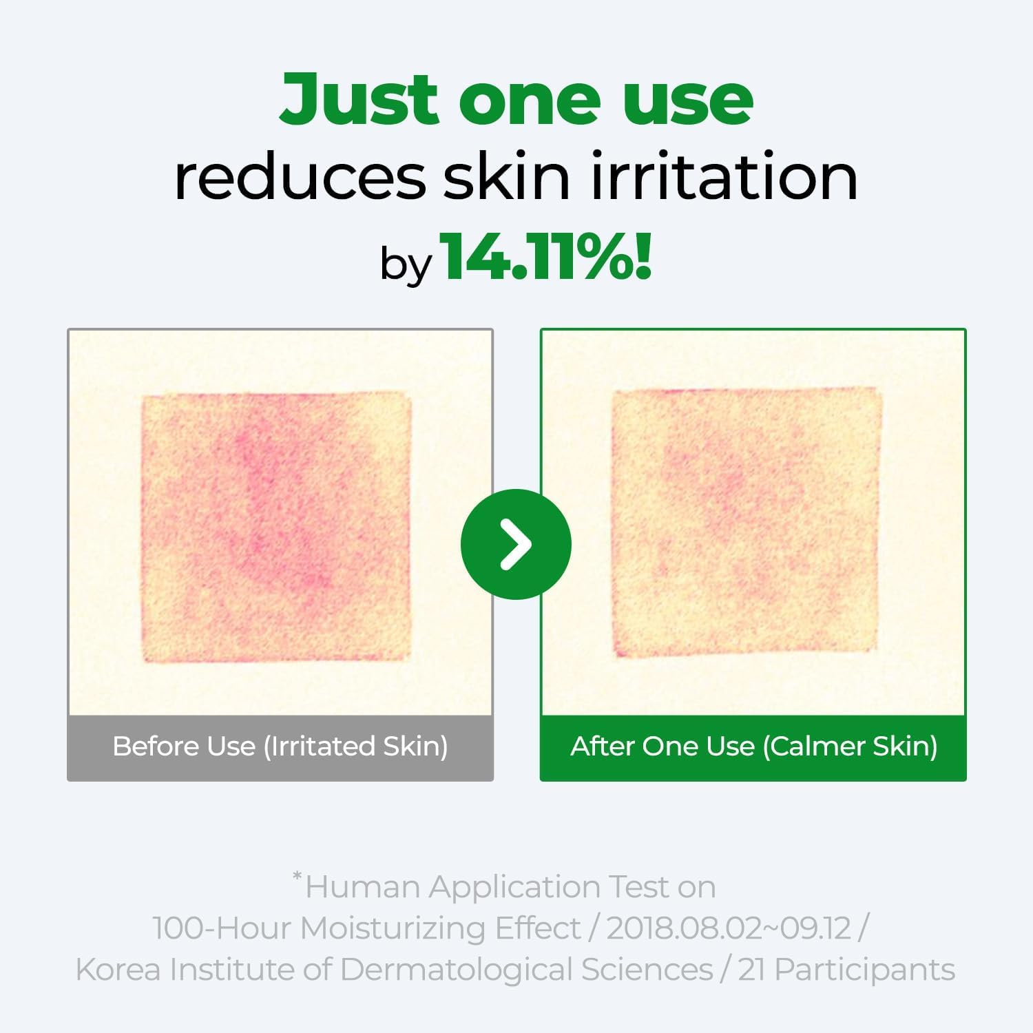 Kim Jeong Moon Aloe Cure Intensive 2X Cream blend of 17 plant oils.