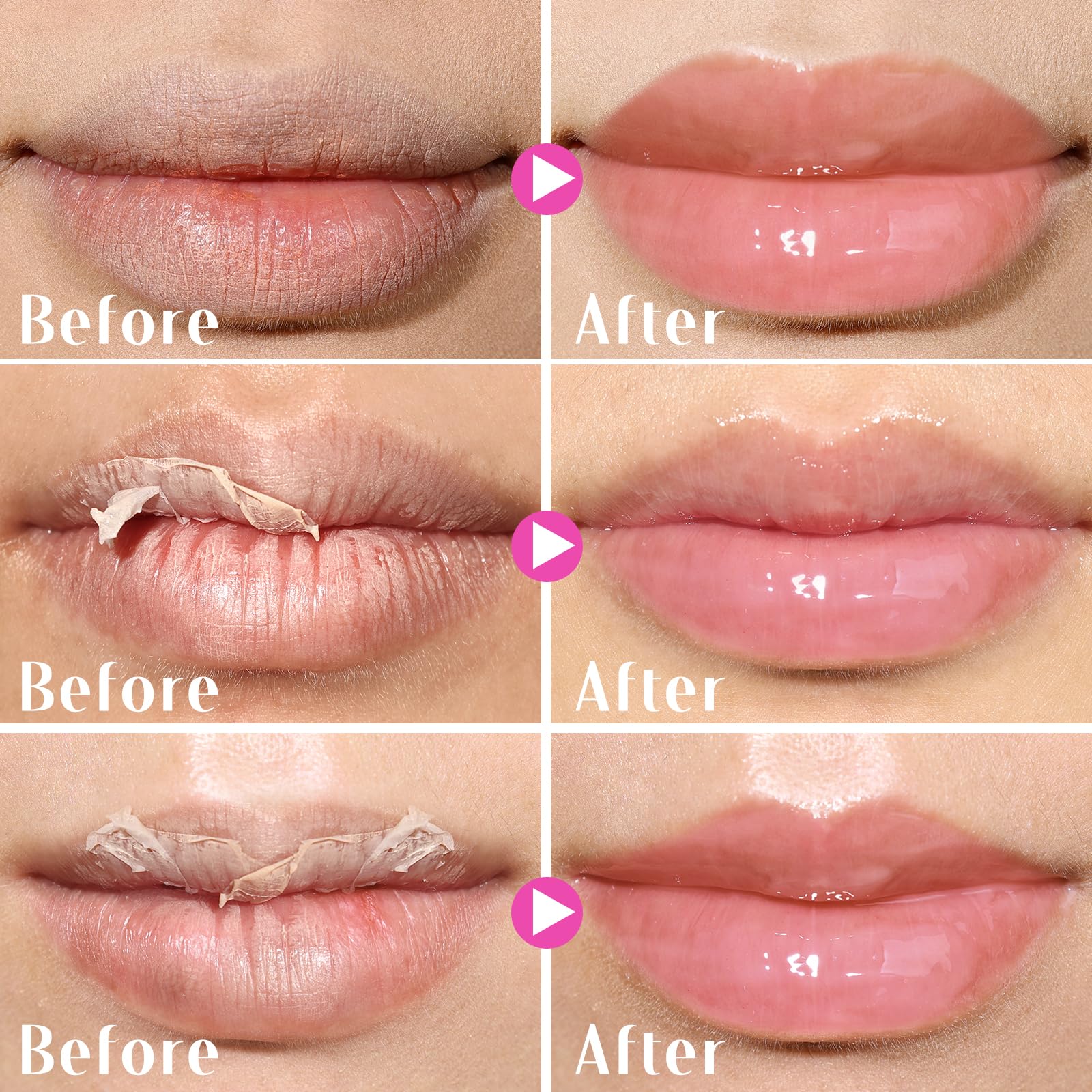 KIMUSE Lip Mask Set vitamin-c enriched formula for healthier-looking lips