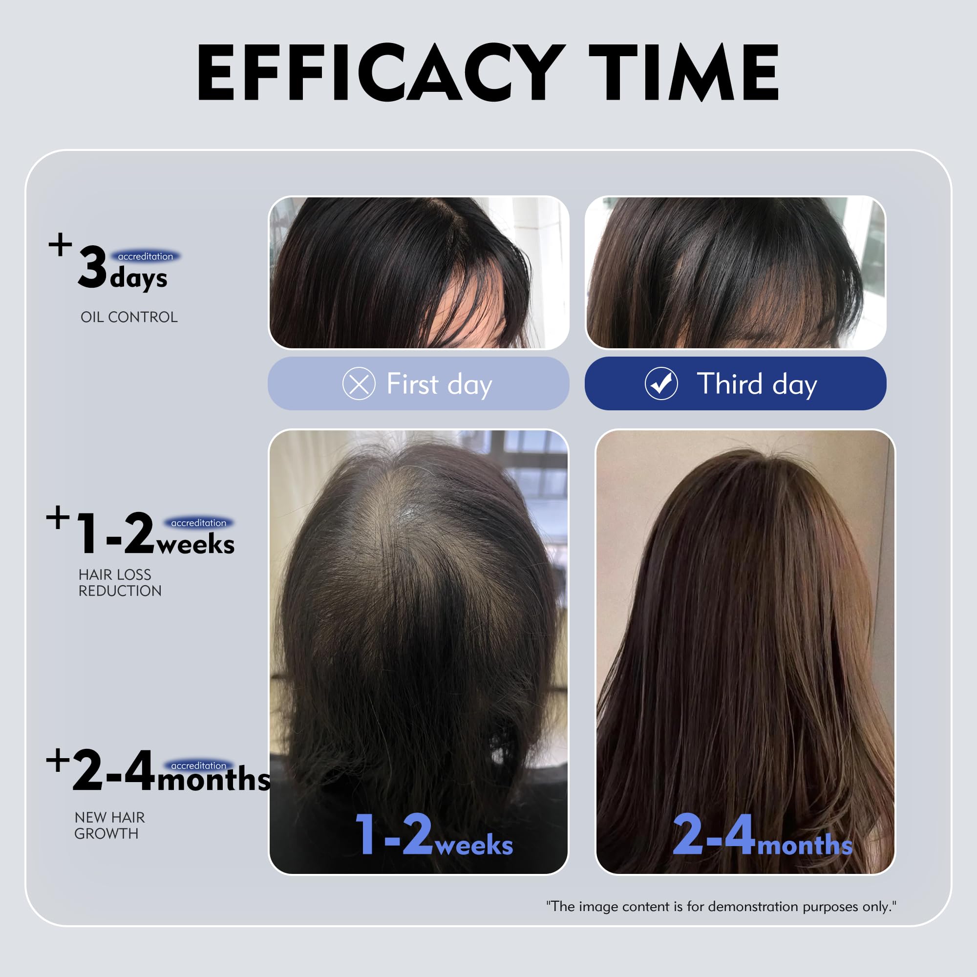 KINTOR KX-826 oil-balance feature for balanced scalp oil