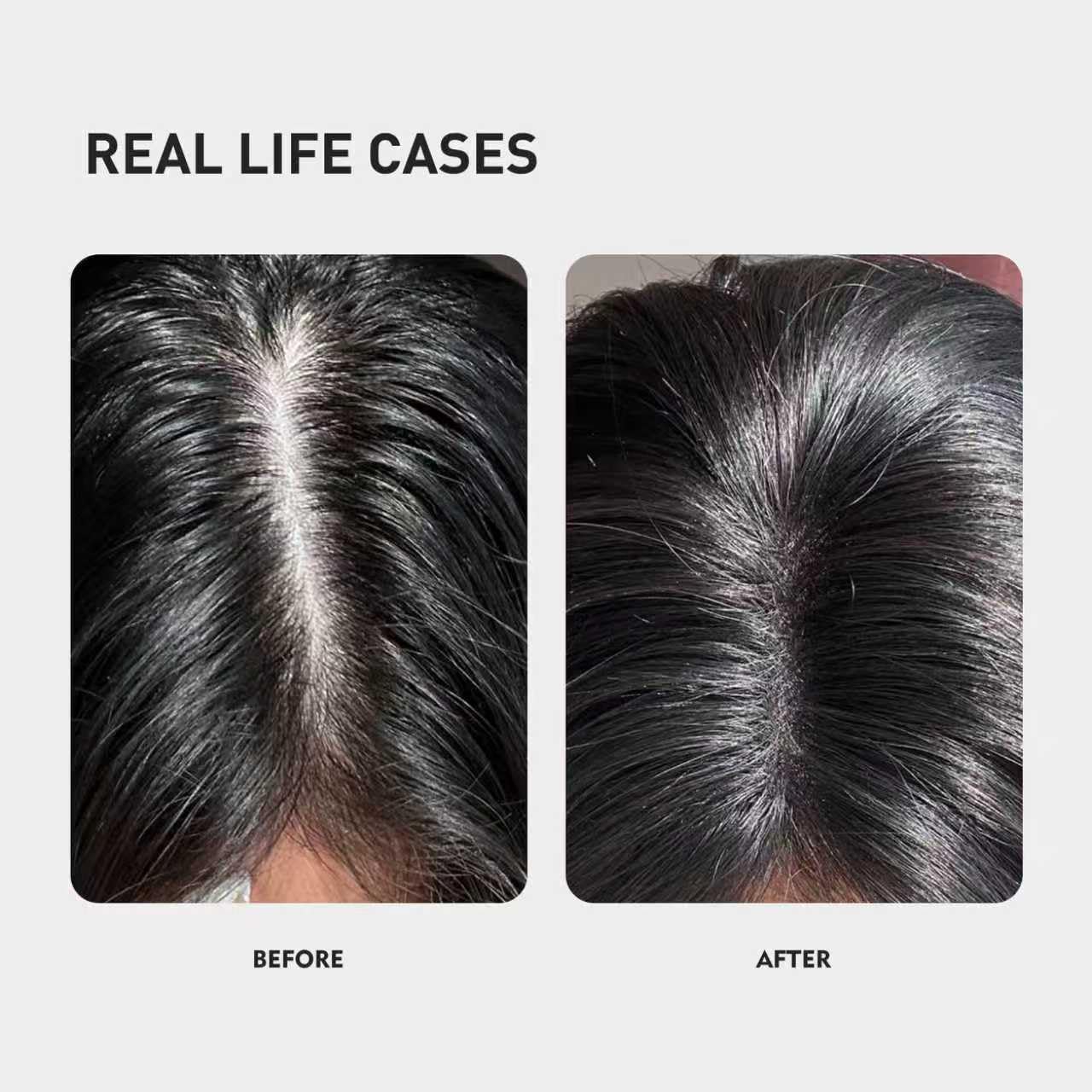 KINTOR KX-826 scalp-application showing targeted root treatment