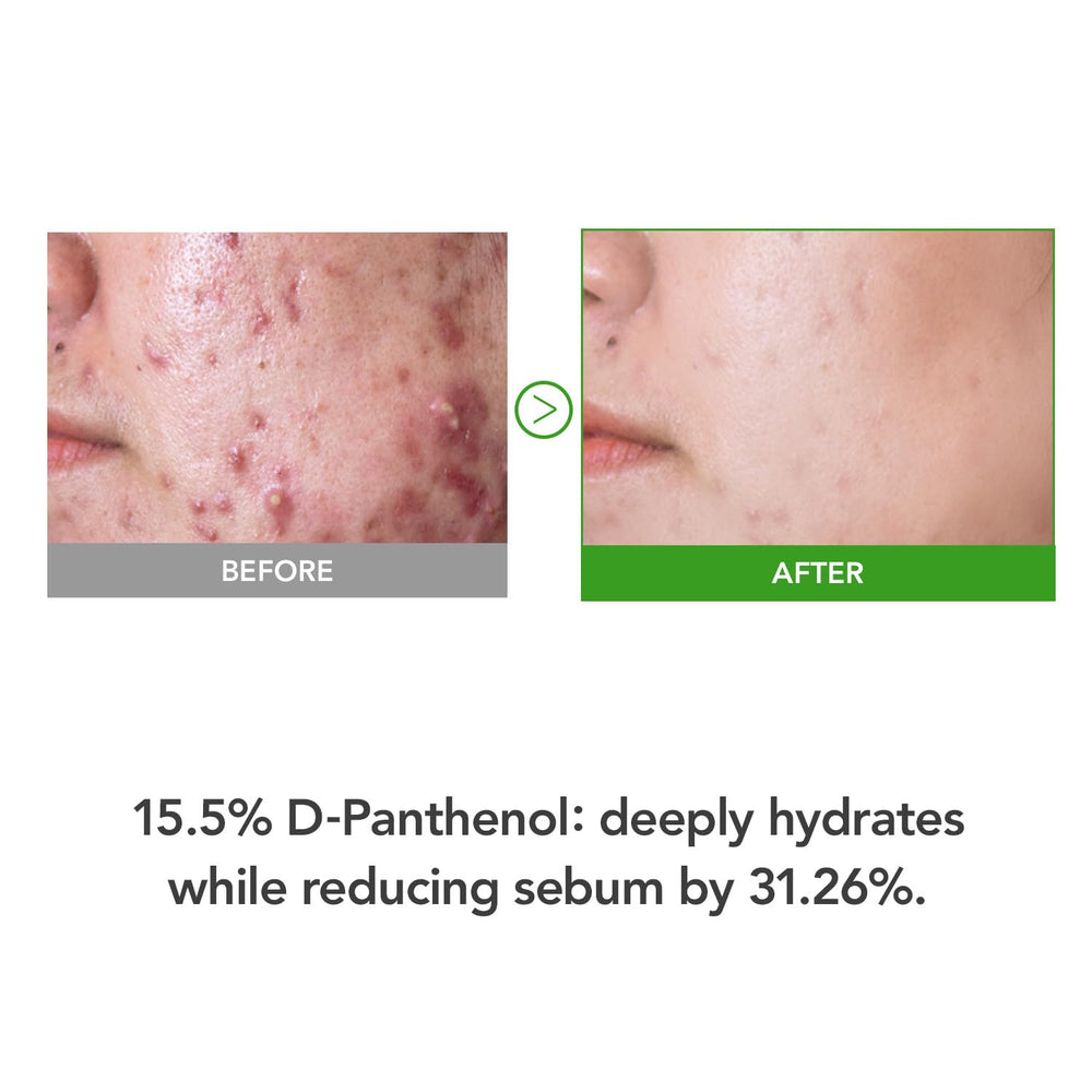 KIOSKIN D-Panthenol high-dose illustration highlights barrier support and moisture retention.