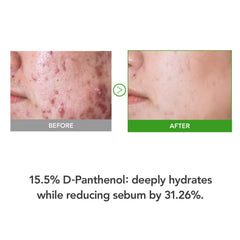 KIOSKIN D-Panthenol high-dose illustration highlights barrier support and moisture retention.