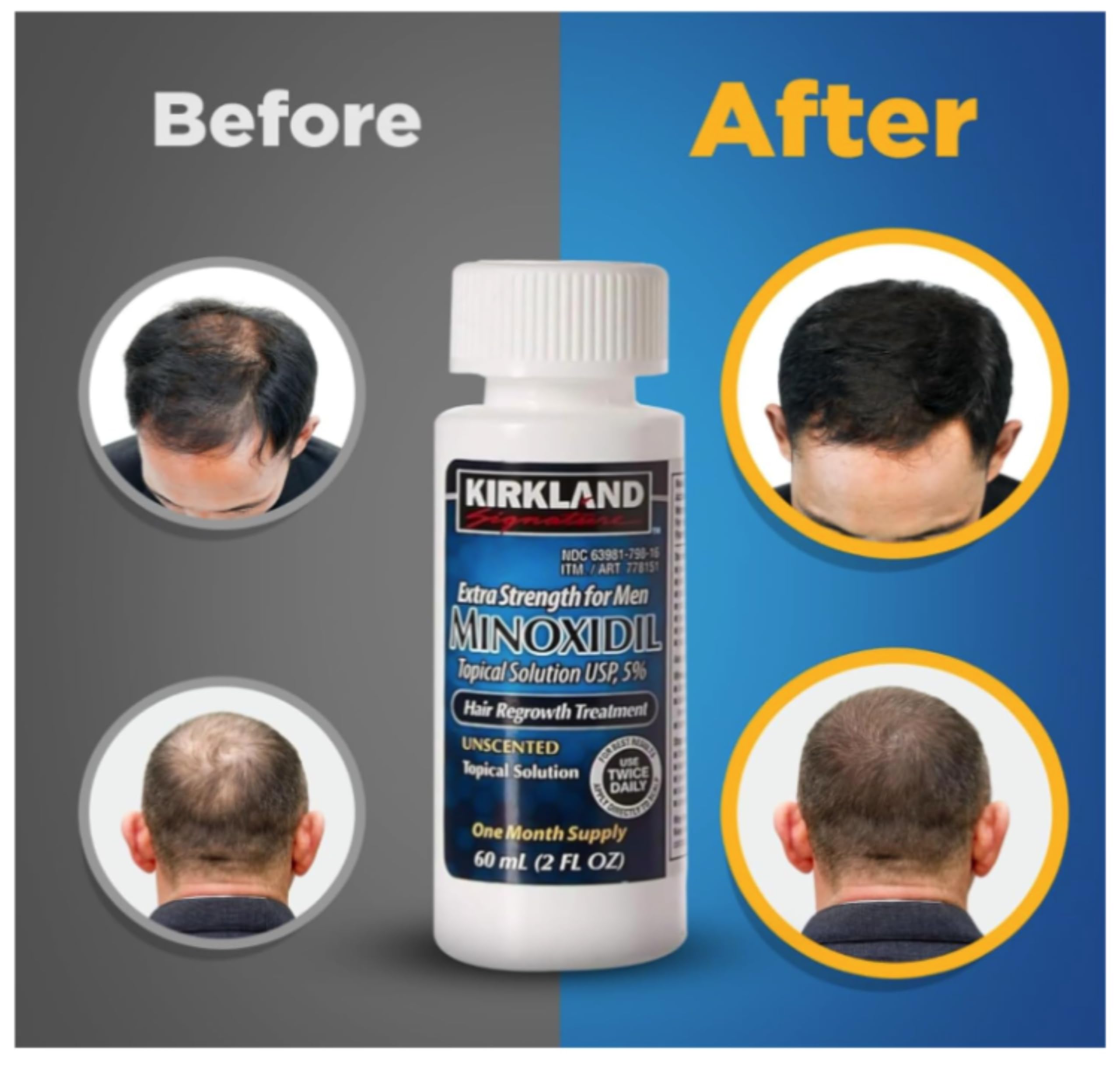 Kirkland Signature Minoxidil packaging close-up with clear product labeling