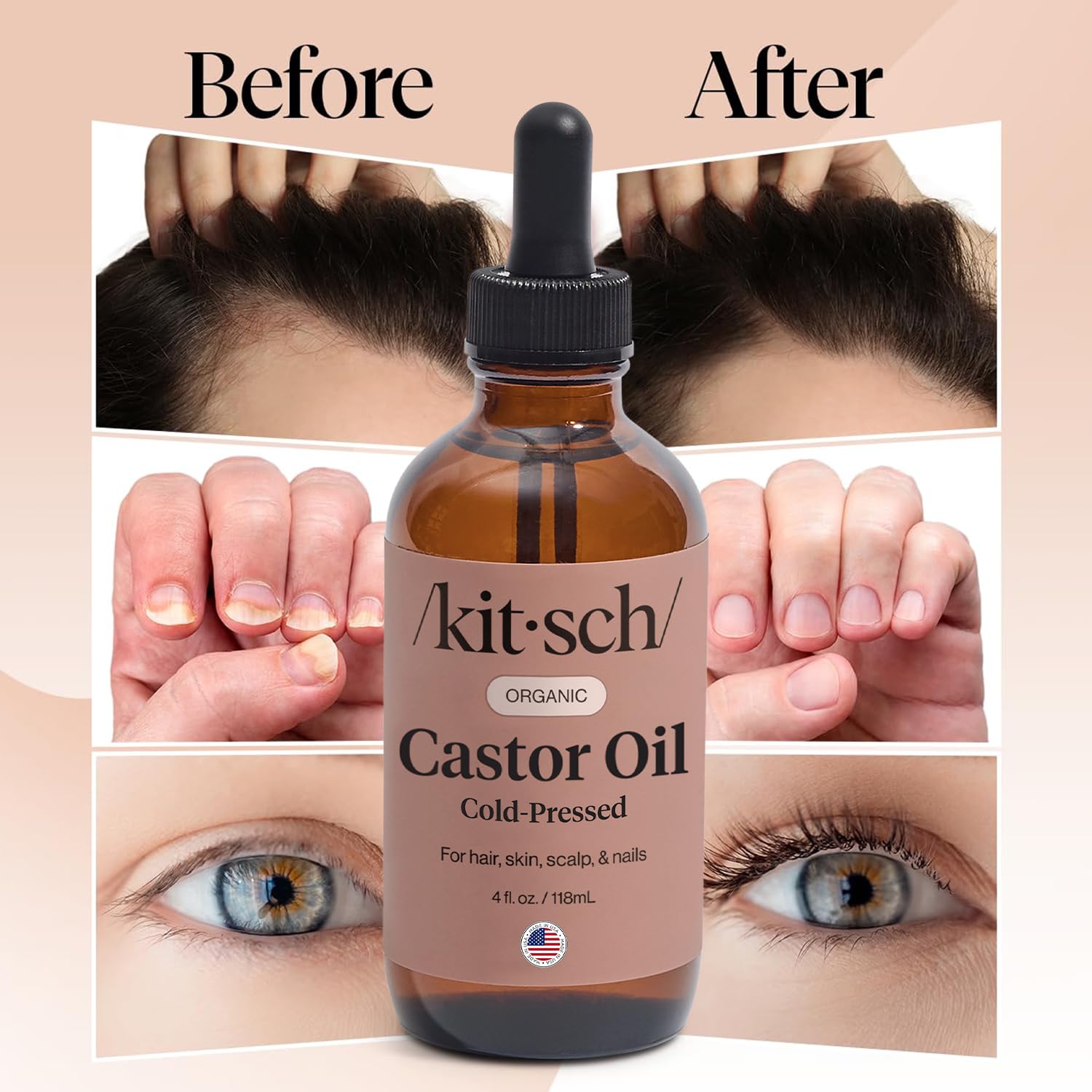 Kitsch castor oil scalp-massage for conditioning