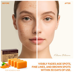 KlearBloom Kojic Acid Turmeric Soap bars top view highlighting compact bundle