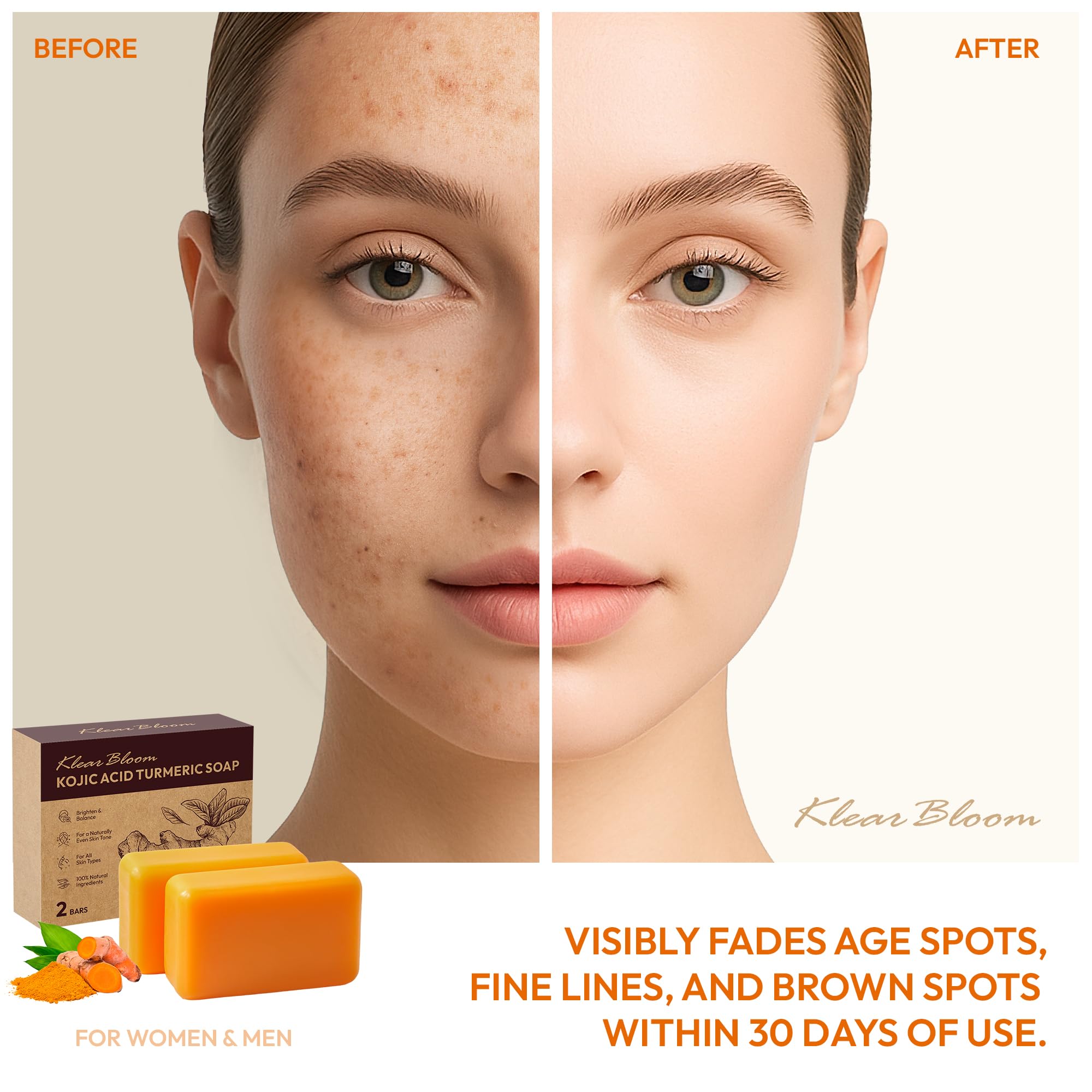 KlearBloom Kojic Turmeric Soap bar holder-display for daily skincare routine.