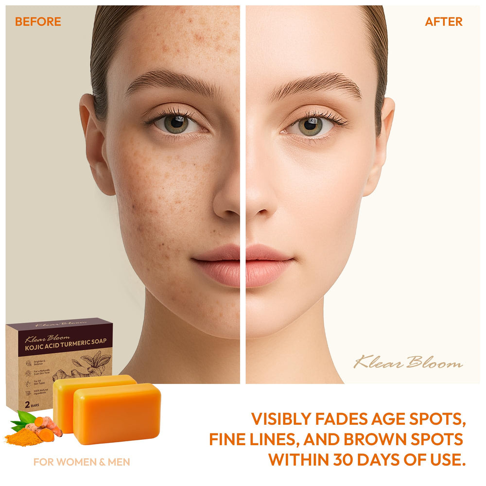 KlearBloom Kojic Turmeric Soap bar holder-display for daily skincare routine.