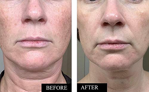 Kleem Organics Hyaluronic acid serum hydration droplets on skin.