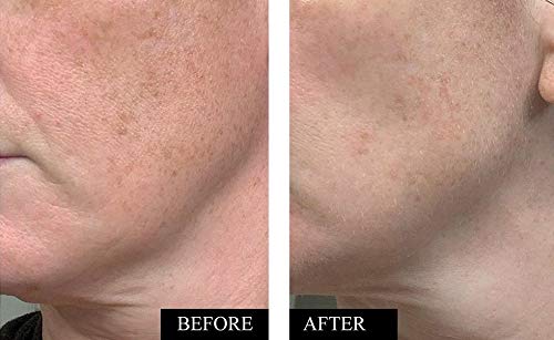 Kleem Organics Vitamin E serum strengthens skin barrier and protection.