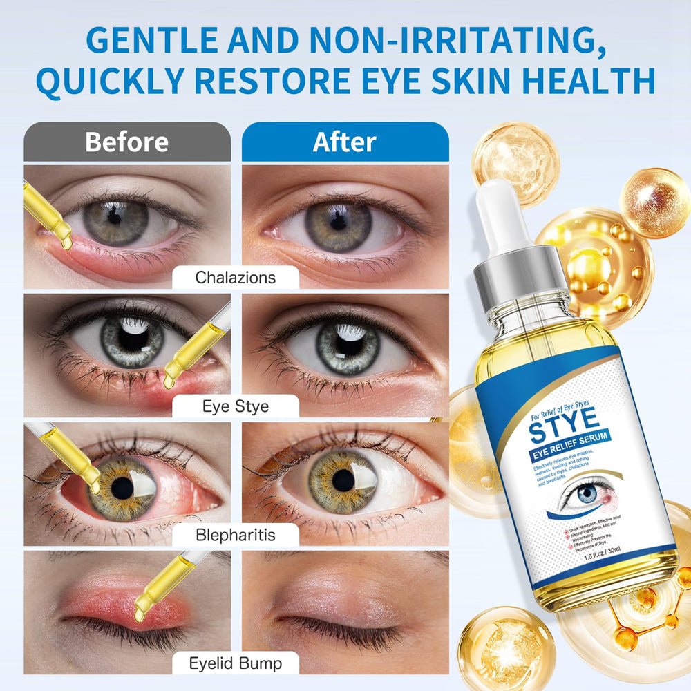 KODASNY Stye Eye Treatment packaging displays plant-derived ingredients and a clean, gentle formulation.