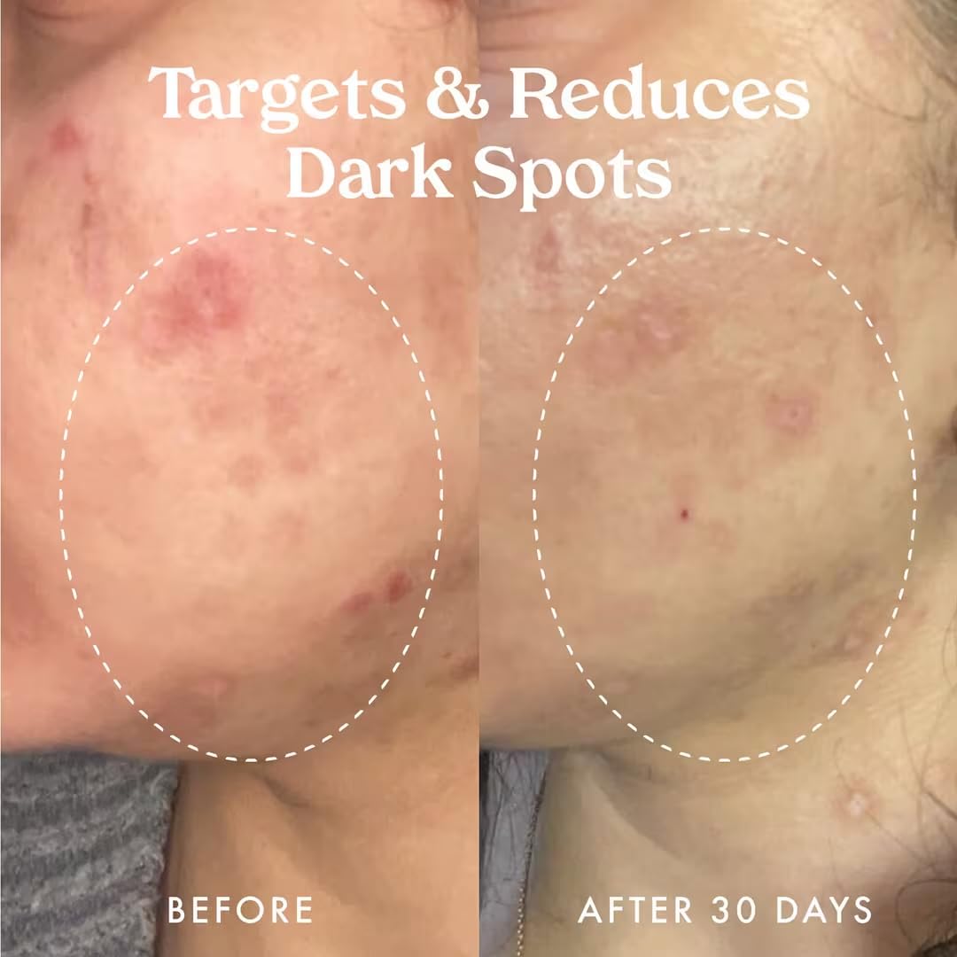 Kopari Star Bright on-skin application shows quick absorption and even tone.