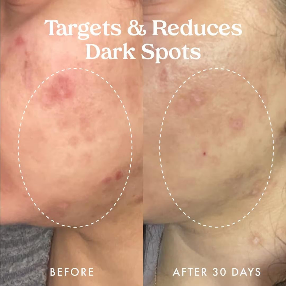 Kopari Star Bright on-skin application shows quick absorption and even tone.